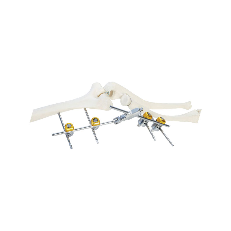 Elbow joint frame