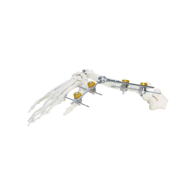 Wrist joint frame