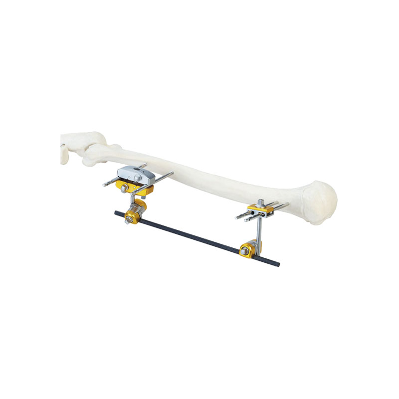 Humerus diaphysis single-side frame